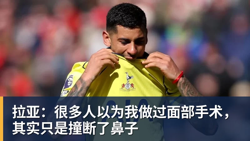 拉亚:很多人以为我做过面部手术,其实只是撞断了鼻子 拉亚:很多人以为我做过面部手术,其实只是撞断了鼻子